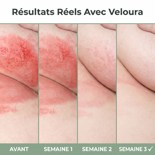 Veloura – Crème Soulagement Intertrigo