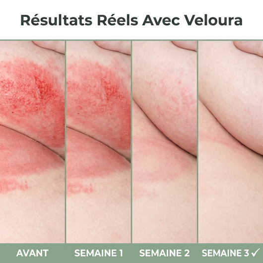 Veloura – Crème Soulagement Intertrigo