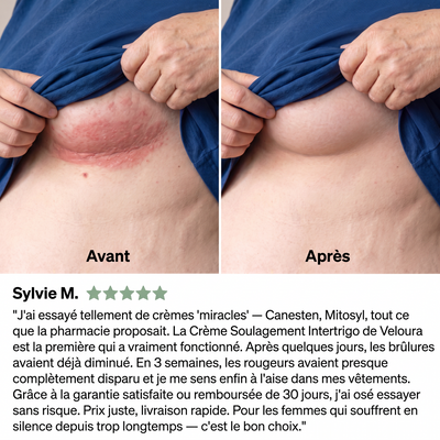 Veloura – Crème Soulagement Intertrigo