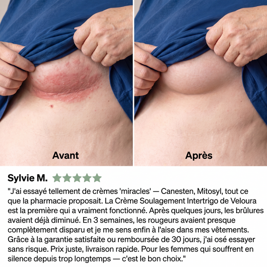 Veloura – Crème Soulagement Intertrigo